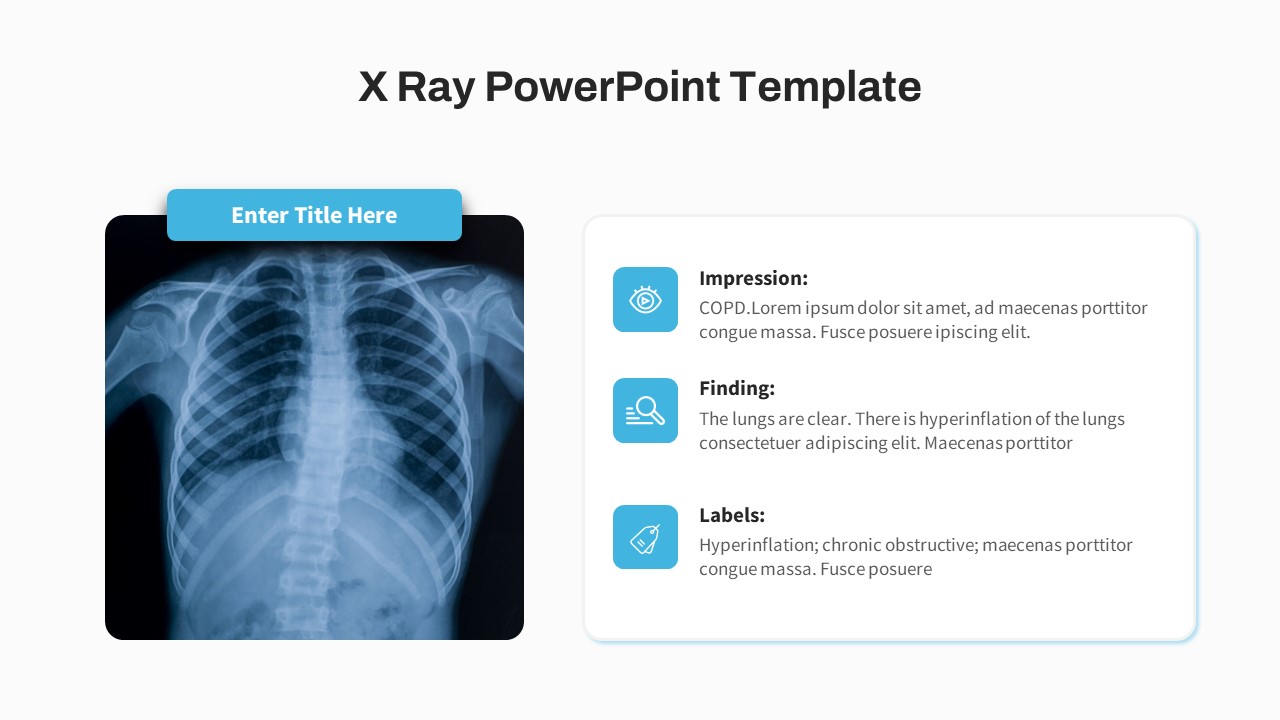 X Ray PowerPoint Template Free Slide For Presentations